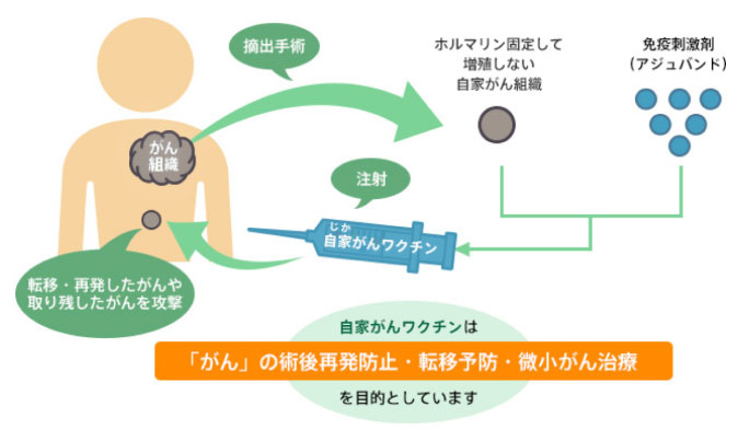 自家がんワクチン