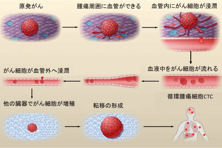 CTCの図